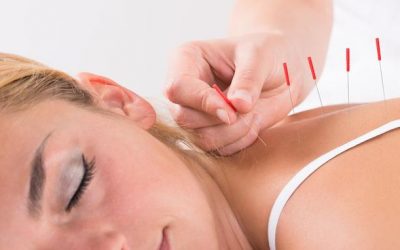 Comment l’acupuncture est utilisée contre les douleurs